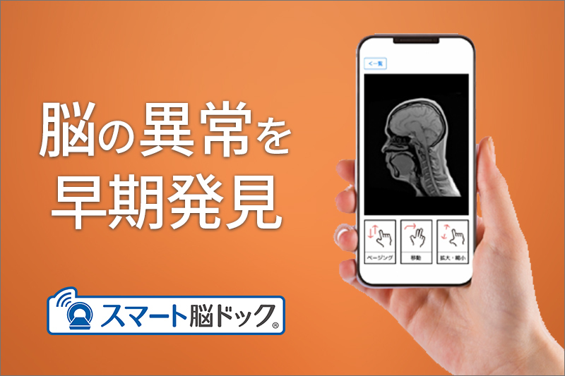 【PR】スマート脳ドックギフトチケット【スマートスキャン株式会社】